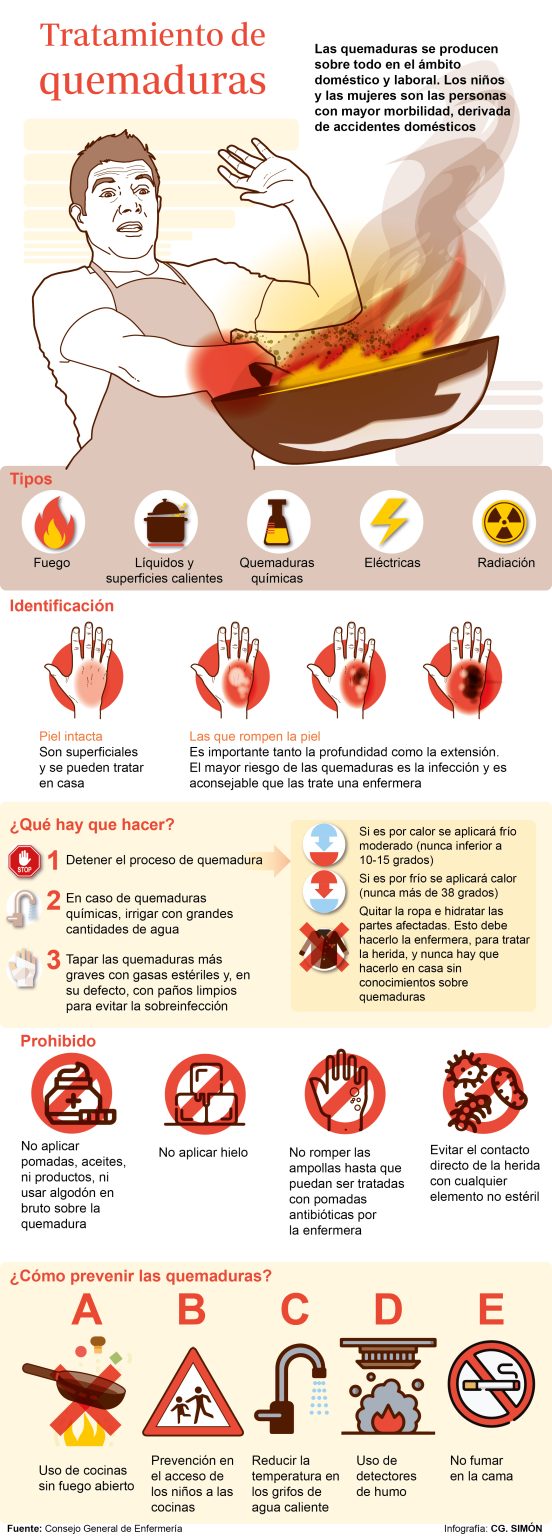 Tratamiento adecuado para quemaduras: evita complicaciones y riesgos